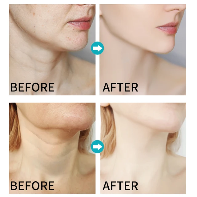Dr Rashel Neck Cream - Dr Rashel Pakistan