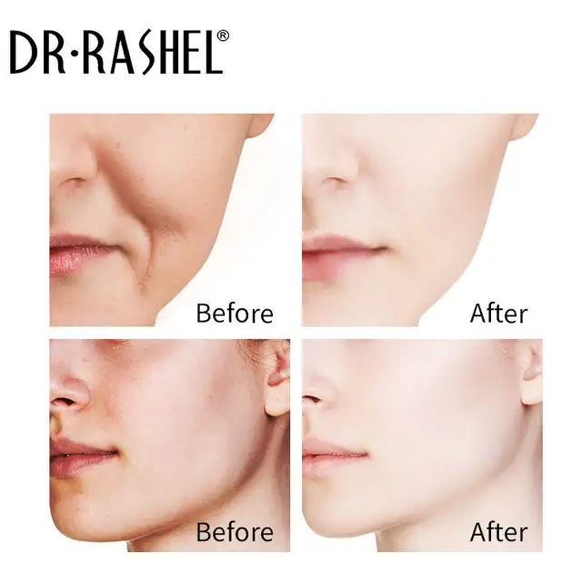 Dr Rashel Whitening Fade Soap